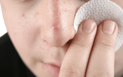 Daily Toner For Acne Prone Skin - Aromantic UK