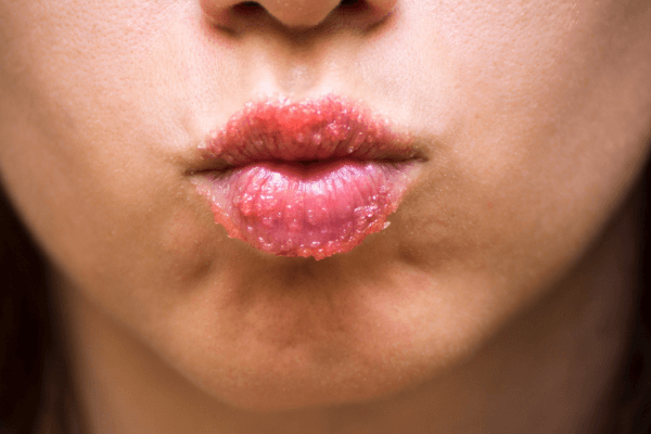 Emulsified Lip Scrub - Aromantic UK
