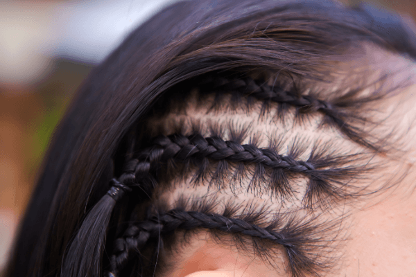 Itchy Scalp Serum