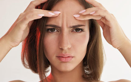The 8 Best Ingredients to Help Take Control of Oily Skin - Aromantic UK